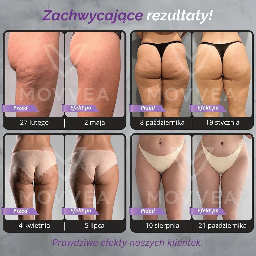 MOVVEA 3D Legginsy Ciemnoszare