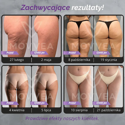 MOVVEA 3D Legginsy Ciemnoszare